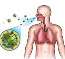 Pneumonie: contagioasă sau nu. Tipurile, agenții patogeni și modul în care sunt transmise