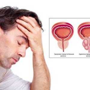 Boli ale prostatei: simptome