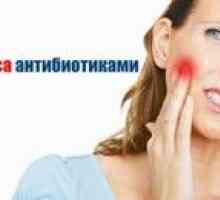Antibiotic cu spumă de dinți la un adult
