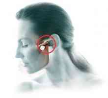 Artrita articulară maxilo-facială: simptome și tratament
