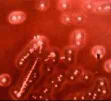Bacteriile streptococcus viridans (streptococcus viridans)