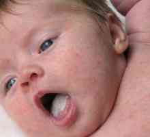 Acoperire albă pe limba copilului