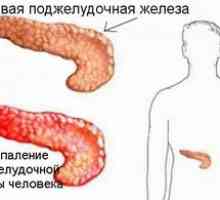 Boli ale pancreasului: simptome și tratament