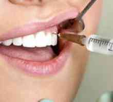 Este dureros să scoateți molarul?