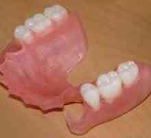 Proteze detașabile parțiale, structuri dentare