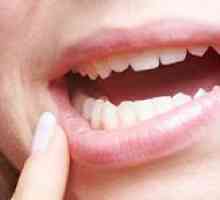 Ce se întâmplă dacă gingia doare? Metode de tratament