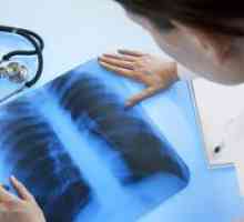 Care este îmbunătățirea modelului pulmonar pe radiografia?