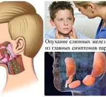 Ce o boală oreion epidemie: simptome și tratament