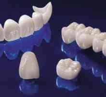 Coroane de zirconiu în stomatologia modernă