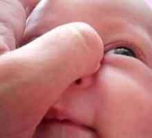 Dacryocystita la nou-nascuti, simptome si tratament