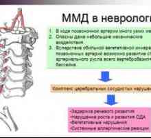 Diagnosticul neurologului mmd (disfuncție minimă a creierului)