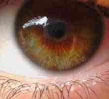 Distrofie și degenerare - boli ale retinei