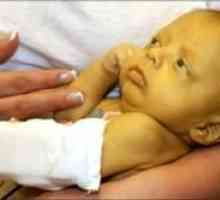 Boala hemolitică a nou-născuților (GBH)