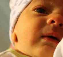 Hemolitice icter la nou-născuți