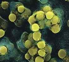 Hemolitic Streptococcus: tratamentul hemoliticelor