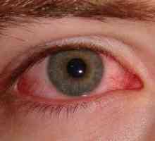 Unguente oftalmice pentru conjunctivită pentru copii