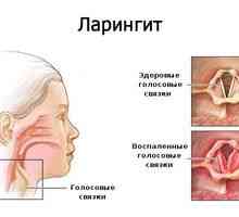 Inhalarea cu hidrocortizon cu laringită la copil