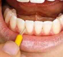 Perie pentru curățarea dentară: ce ar trebui să fie o perie pentru dinți?
