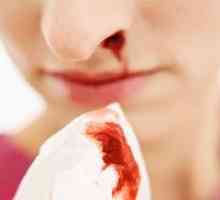 De ce nasul sânge - ceea ce spun cărțile de vis