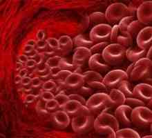 Cum de a scădea nivelul hemoglobinei în sângele unui bărbat?