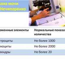 Cum să colectați corect analizele de urină de către nechyporenko