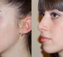 Cum să eliminați o cocoșă pe nas: metode pentru a face față unui defect