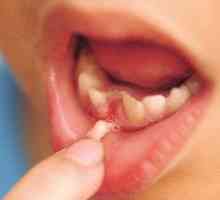 Cum să rupi un dinte copilului de la un copil în mod corect și fără durere