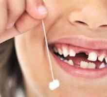 Ce fel de dinți de copil se schimbă în copil pentru permanență