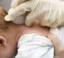 Chist în cap la nou-născuți: cauze și consecințe