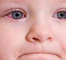 Conjunctivita la copii - cum se trateaza boala la un copil?