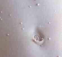 Molluscum contagiosum pe pielea copilului: tratament și fotografii