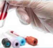 Testul cantitativ pentru tuberculoza in vitro