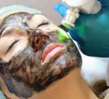 Curățarea feței cu laser cu peeling de carbon