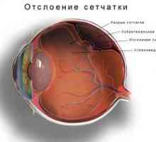 Tratamentul detașării retinei: tipurile de operații și costurile acestora