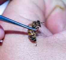 Tratamentul cu albine: beneficii, contraindicații, rețete populare