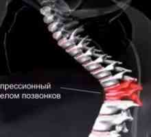 Tratamentul persoanelor vârstnice cu o fractură de compresie a coloanei vertebrale