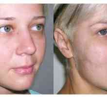 Lifting cream - cel mai bun remediu pentru pielea feței cu efectul de bretele