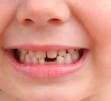 Dinți de dinți: la ce vârstă încep să cadă?