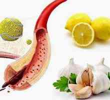 Remedii populare pentru purificarea vaselor de sânge de la colesterol