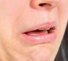 Gust neplăcut în gură: cauze, simptome și tratament
