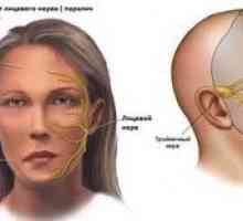 Nevralgia nervului trigeminal: descrierea simptomelor și a tratamentului