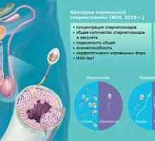 Normele pentru analiza spermatogramei la bărbați și cauzele anomaliilor