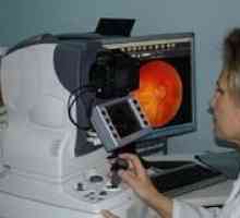 Examen oftalmic care prezintă caracteristicile fondului