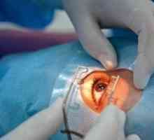 Operațiunea de înlocuire a lentilei ochiului