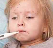 Complicații la copii după varicela