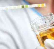Principalele motive pentru apariția urinei tulburate la un copil