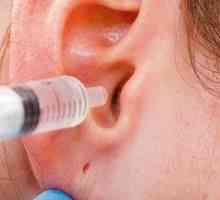 Peroxidul de hidrogen pentru urechi: auto-curățarea dopului de sulf din ureche