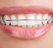 Plăci pentru alinierea dinților: placă ortodontică