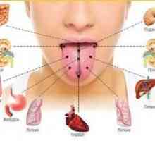 De ce doare limba: cauzele problemei și modalitățile de tratament