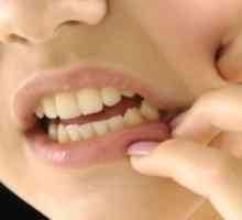 De ce nu pot denuda gingia: cauzele bolii și tratamentul